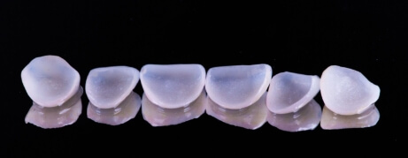Several white dental restorations against black background