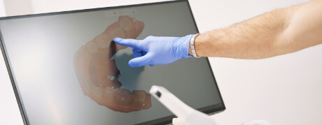 Dentist pointing to digital impressions of teeth on a screen