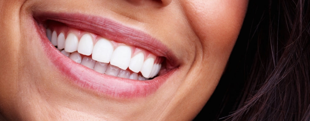 Close up of smiling woman with straight white teeth