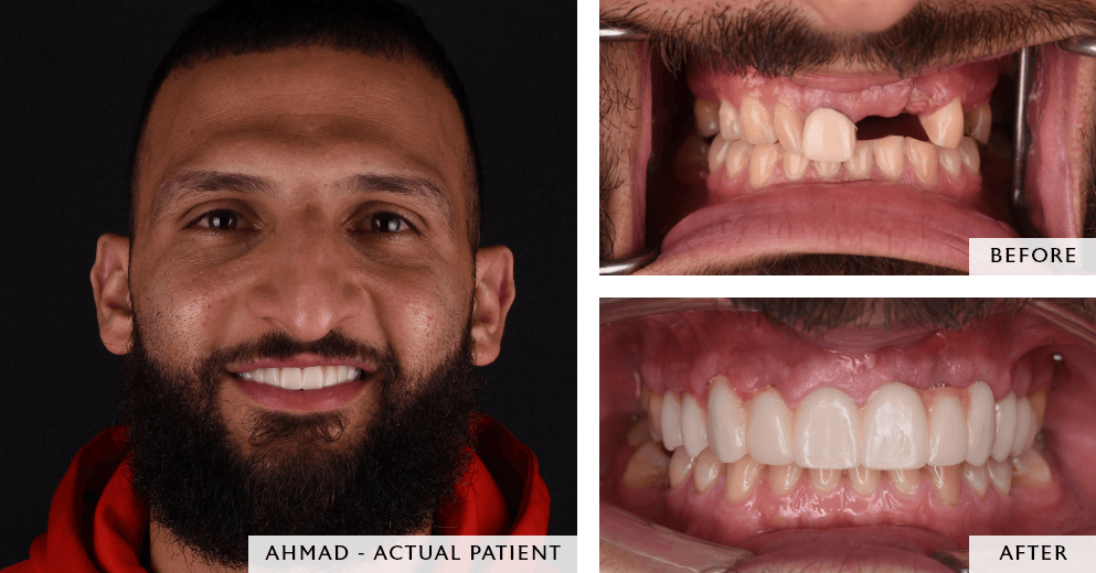 before and after images