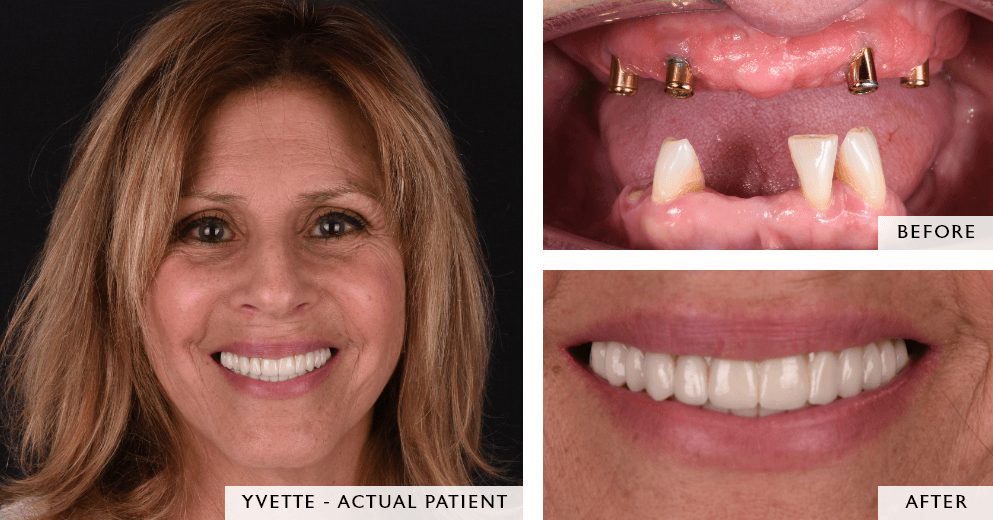 before and after images