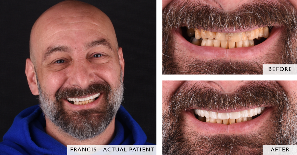 before and after images