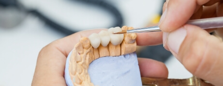 Dental ceramist creating a dental bridge