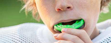 Boy placing green athletic mouthguard over his teeth