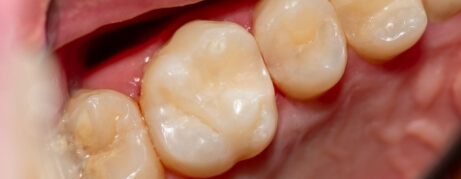 Close up of row of teeth