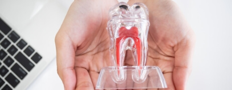 Hands holding a clear model of a tooth