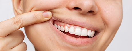 Close up of a person pointing to their teeth