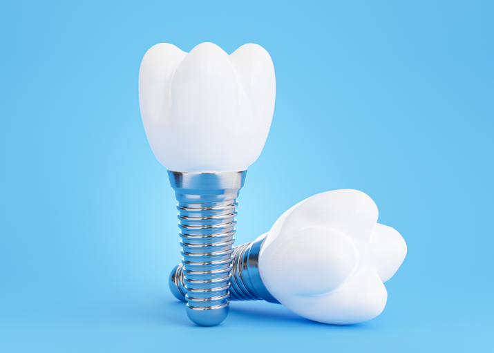 Dental implants